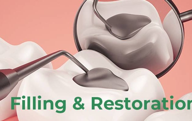 Filling And Restorations