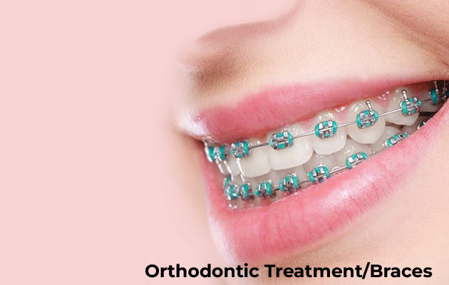 Orthodontic Treatment/Braces