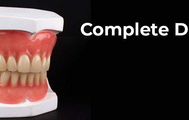 Complete Dentures