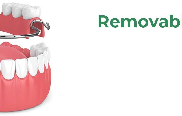 Removable Teeth