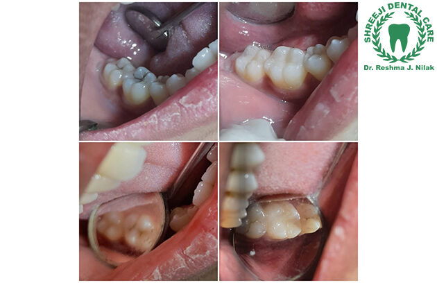 Best Dental Clinic in Baroda