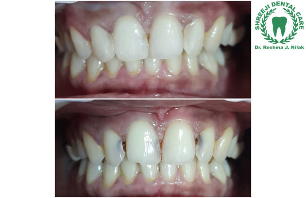 Dr Reshma Nilak's Shreeji Dental Clinic