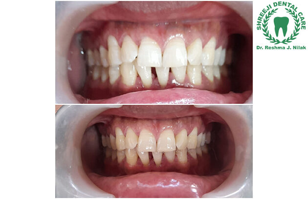 Shreeji Dental Clinic Manjalpur