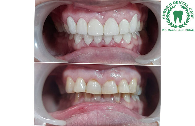 Shreeji Dental Clinic Manjalpur
