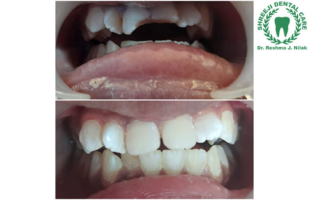 Shreeji Dental Clinic Manjalpur