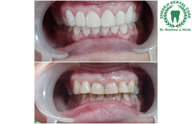 Shreeji Dental Clinic Manjalpur Vadodara