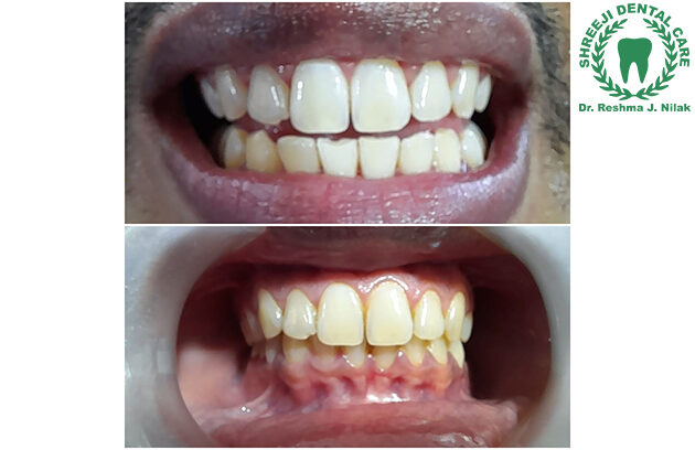 Dental Clinic in Vadodara