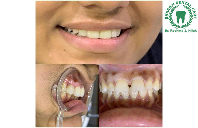 Dental Clinic in Baroda