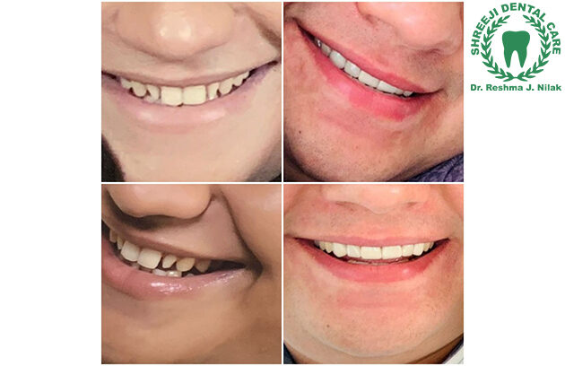 Best Dental Clinic in Baroda