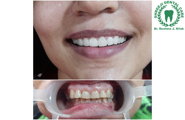 Dr Reshma Nilak's Shreeji Dental Clinic