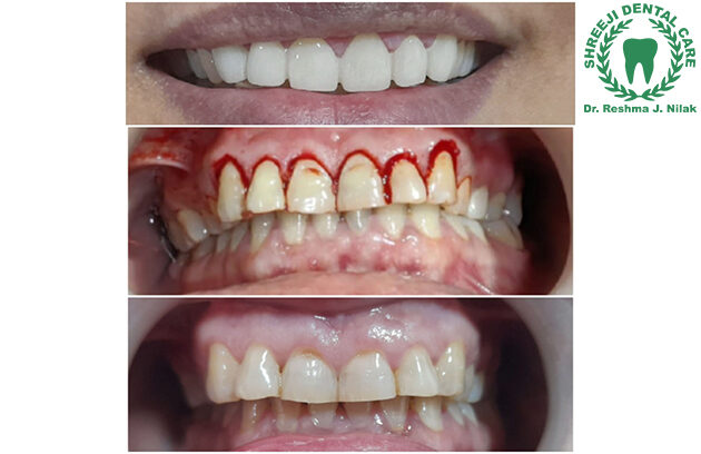 Dr Reshma Nilak's Shreeji Dental Clinic