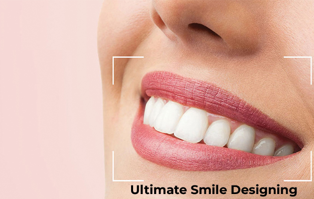 Ultimate Smile Designing